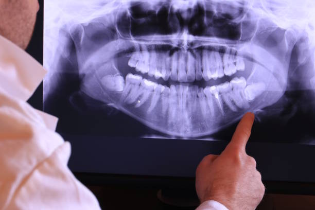 Best Dentist for Tooth Abscess  in Amityville, NY