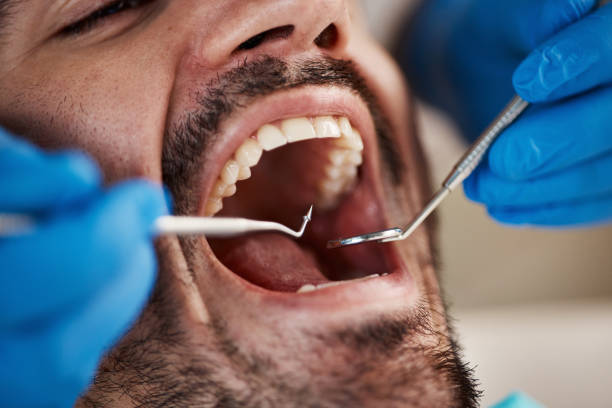 Best Dentist for Dental Trauma  in Amityville, NY