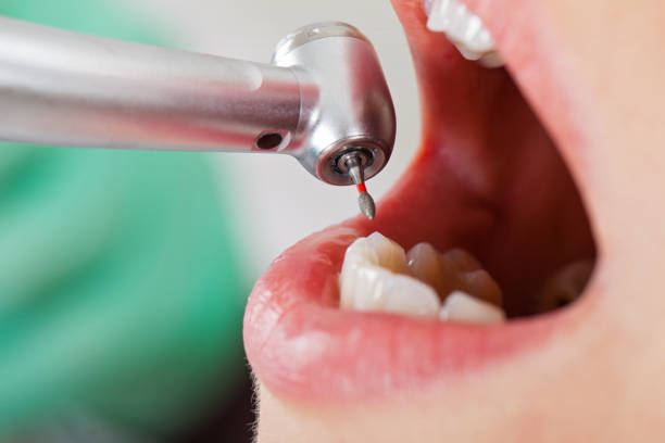 Best Knocked-Out Tooth Emergency  in Amityville, NY